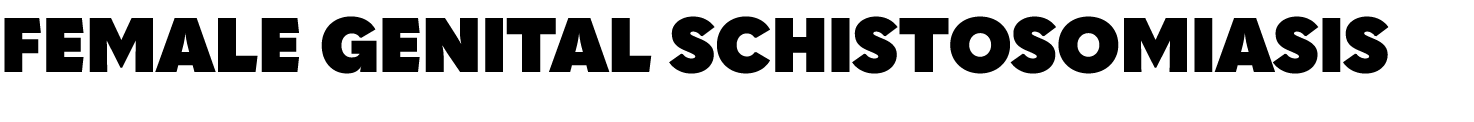 Female Genital Schistosomiasis